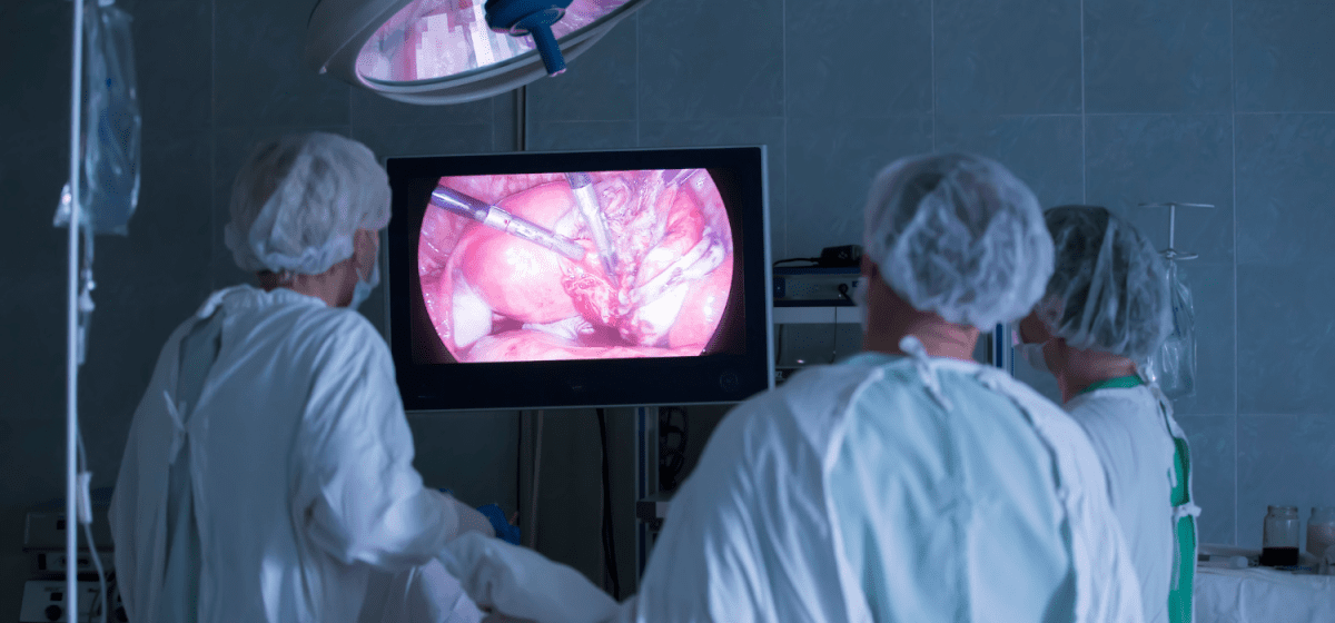 Laparoscopia Rettale Napoli