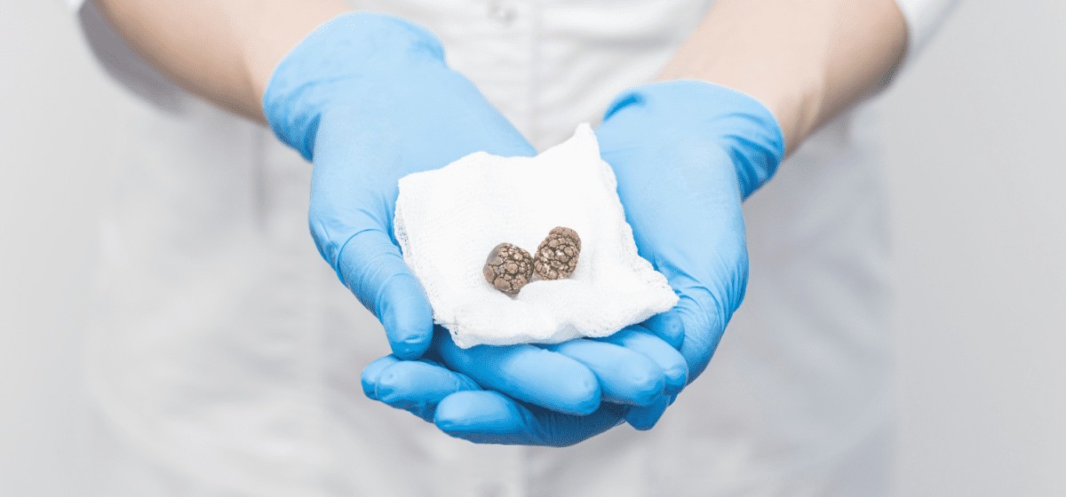 visita per Colecistopatia napoli,colecistopatia napoli